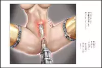 [NEO’GENTLE] Bishoujo Fighter Onaho - Onaho Ninshin Kakutei Hen